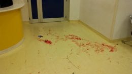 sangue pronto soccorso danni ospedale avezzano (2)