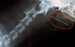 Una radiografia con un ago ingoiato